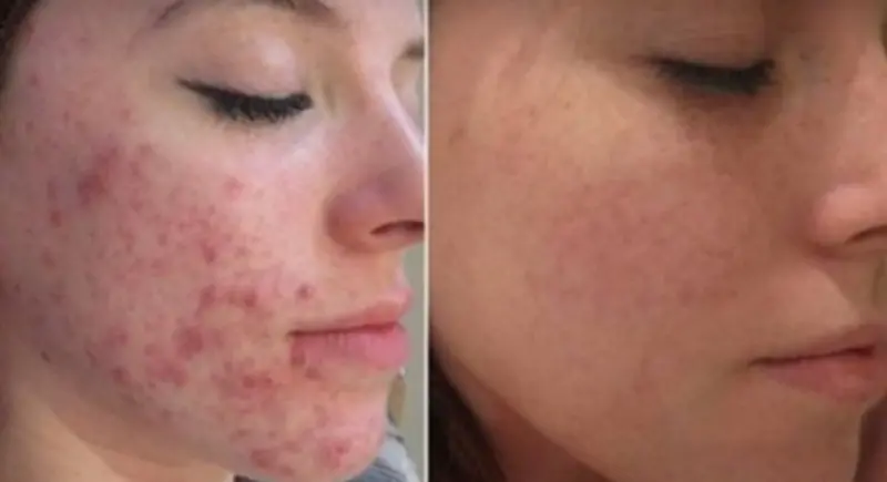 Sem-título-e1599836249744-800x435