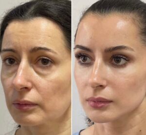 WhatsApp Image 2026-02-18 at 17.38.30